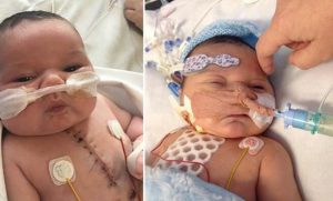 Milagre; bebê nasce com meio coração e sobrevive à cirurgia!